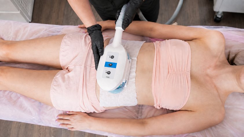 Appareil de cryolipolyse posé sur le ventre d'une femme allongée, soin Cryolipolyse de Biostem